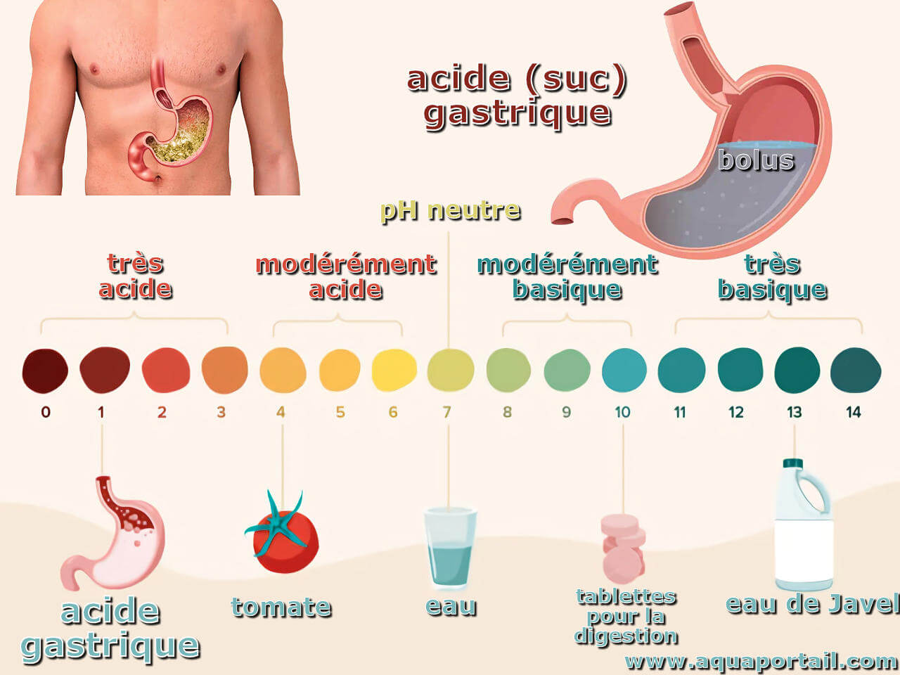 Hyperacidité gastrique